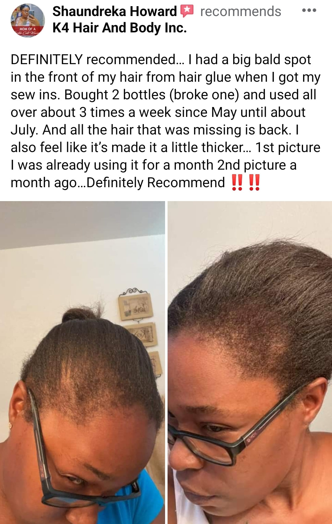 K4 HAIR GROWTH OIL